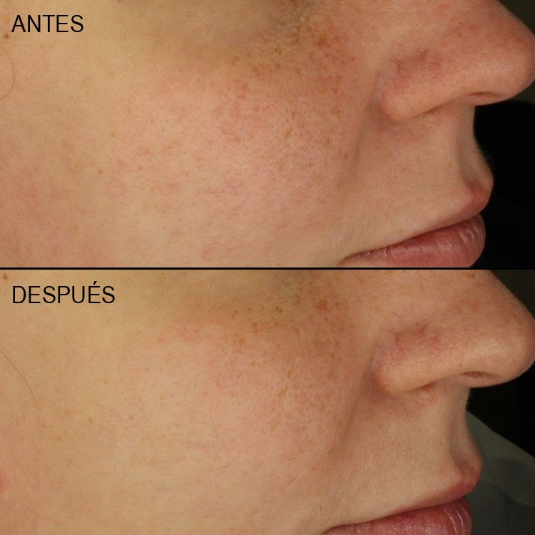 Resultados eficacia Ultra Lipid Repair