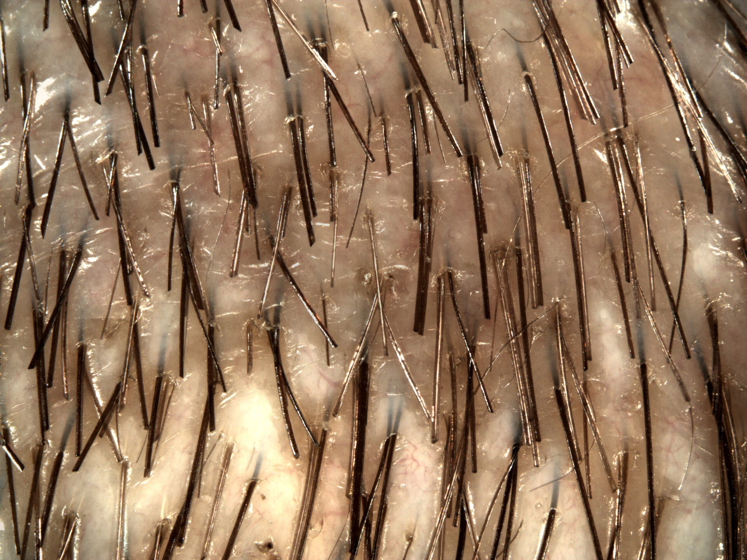 Pelo antes de usar Hair Re-Genesis sobre las canas