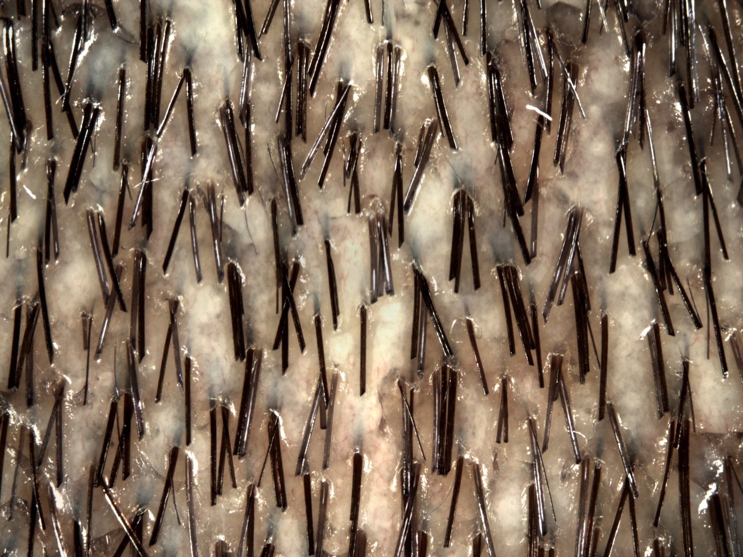 Eficacia de Hair Re-Genesis sobre las canas